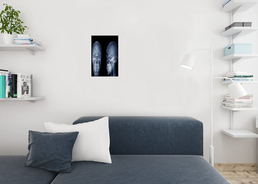 Human Skull X ray Image Front and Side Lateral View Skeleton Anatomy Medical Photo Cool Wall Decor Art Print Poster 12x18