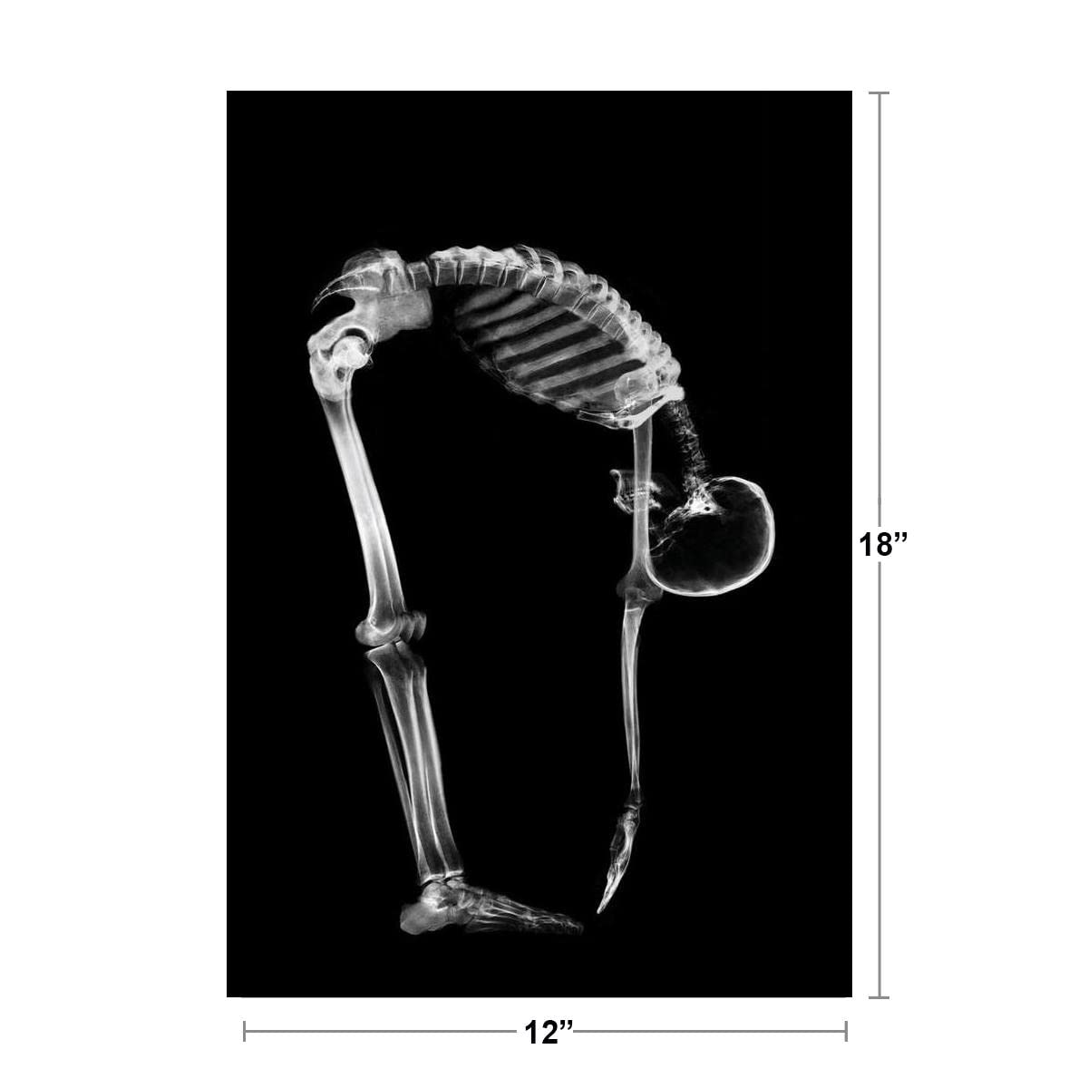 Skeleton Bending Touching Toes Anatomy X Ray Photo Poster Human Body Medical Stretching Photograph Cool Wall Decor Art Print Poster 12x18