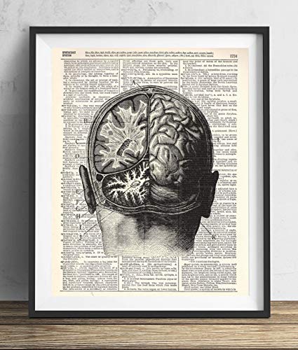 Vintage Anatomy Illustration Art, Dictionary Print, Antique Wall Art Home Decor, Modern Boho, Medical Posters, Farmhouse Decoration 8x10 Inches, Ready To Frame (Brain Dissection)