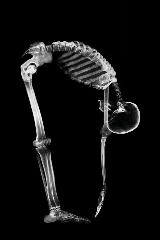 Skeleton Bending Touching Toes Anatomy X Ray Photo Poster Human Body Medical Stretching Photograph Cool Wall Decor Art Print Poster 12x18