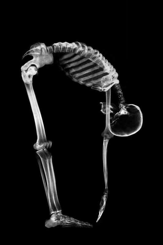 Skeleton Bending Touching Toes Anatomy X Ray Photo Poster Human Body Medical Stretching Photograph Cool Wall Decor Art Print Poster 12x18