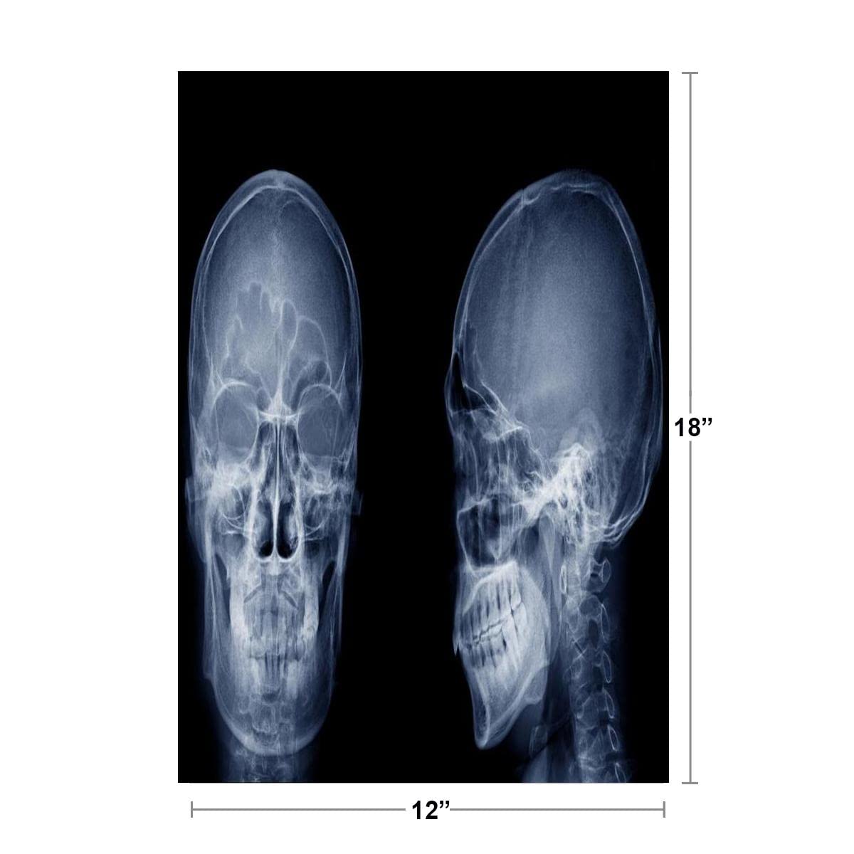 Human Skull X ray Image Front and Side Lateral View Skeleton Anatomy Medical Photo Cool Wall Decor Art Print Poster 12x18